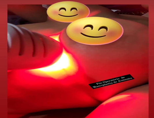 Led/Laserterapia em cicatrização e reparo tecidual.