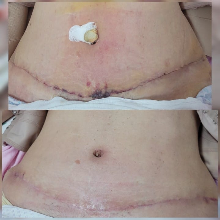  Pós - Operatório de cirurgias plásticas e reparadoras.