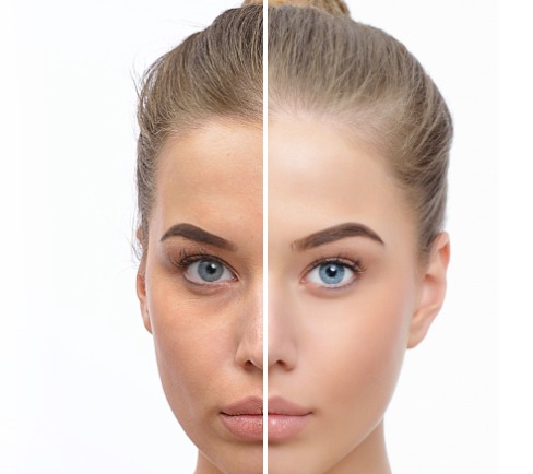 Skinbooster.